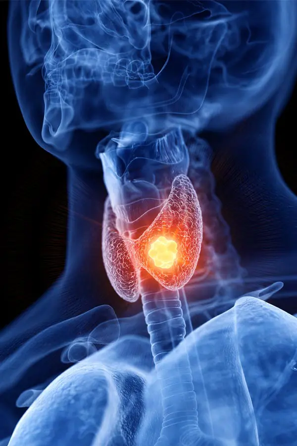 Thyroid-Imbalance-Treatment A 3D illustration of an x-ray of a human neck, highlighting the thyroid. Get help with thyroid imbalance from Healthy Aging Medical Centers of New Jersey in Northern New Jersey.